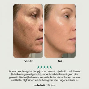 EpilSmooth Pro
