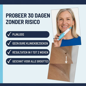 SkinClear™ | Kit Anti-Acrochordons à Domicile