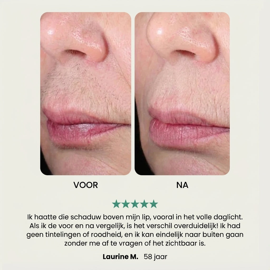EpilSmooth Pro