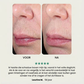 EpilSmooth Pro