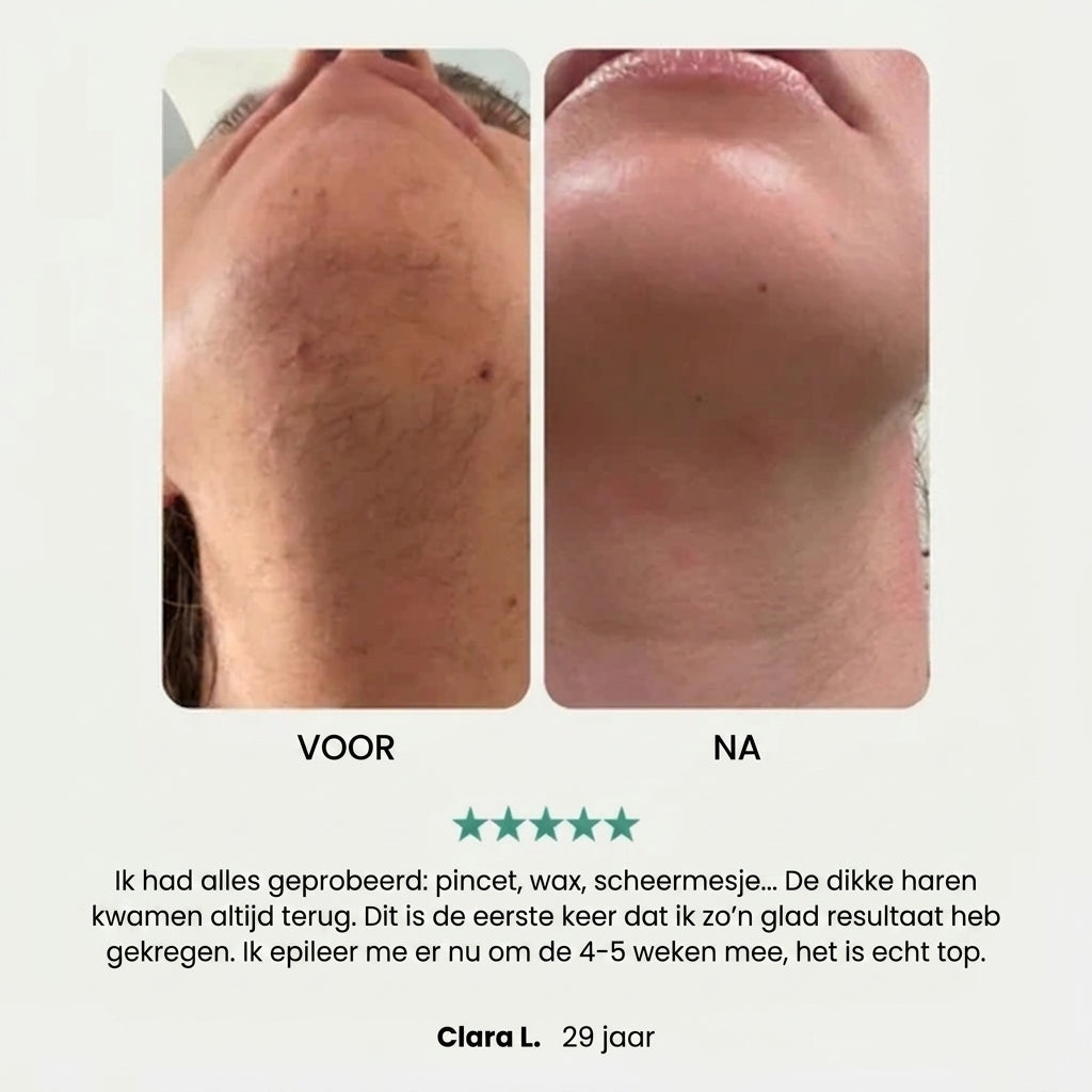 EpilSmooth Pro