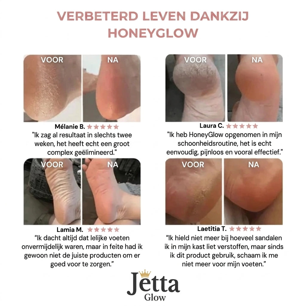 HoneyGlow™ - Kit Beauté Pieds