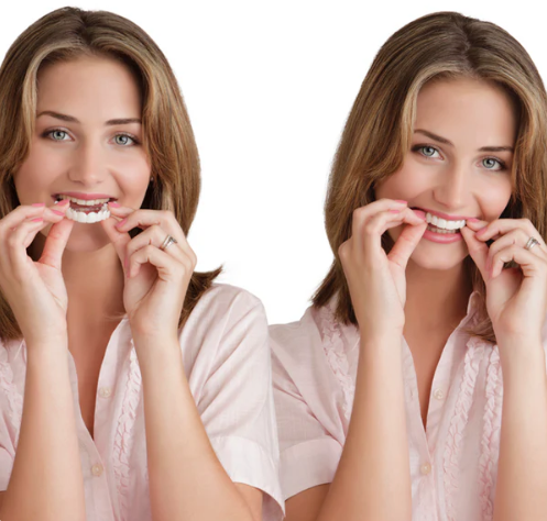 SOURIRE PARFAIT - FACETTES DENTAIRES INFÉRIEURES ET SUPÉRIEURES